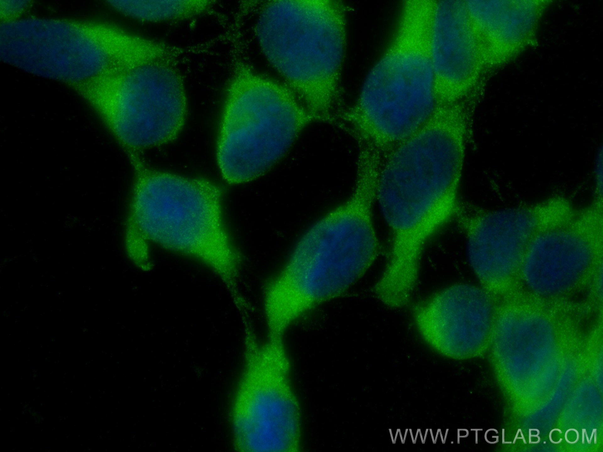 Immunofluorescence (IF) / fluorescent staining of HEK-293 cells using Rab18 Polyclonal antibody (11304-1-AP)
