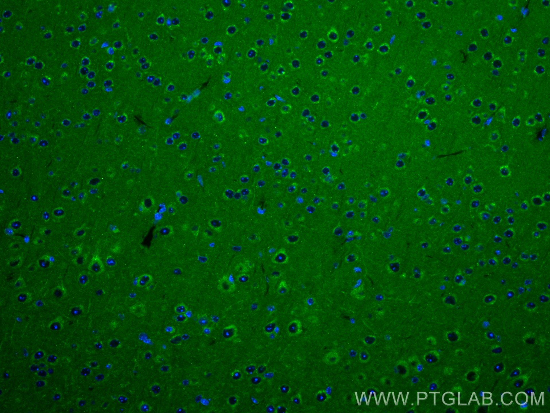 Immunofluorescence (IF) / fluorescent staining of mouse brain tissue using Rab18 Polyclonal antibody (11304-1-AP)