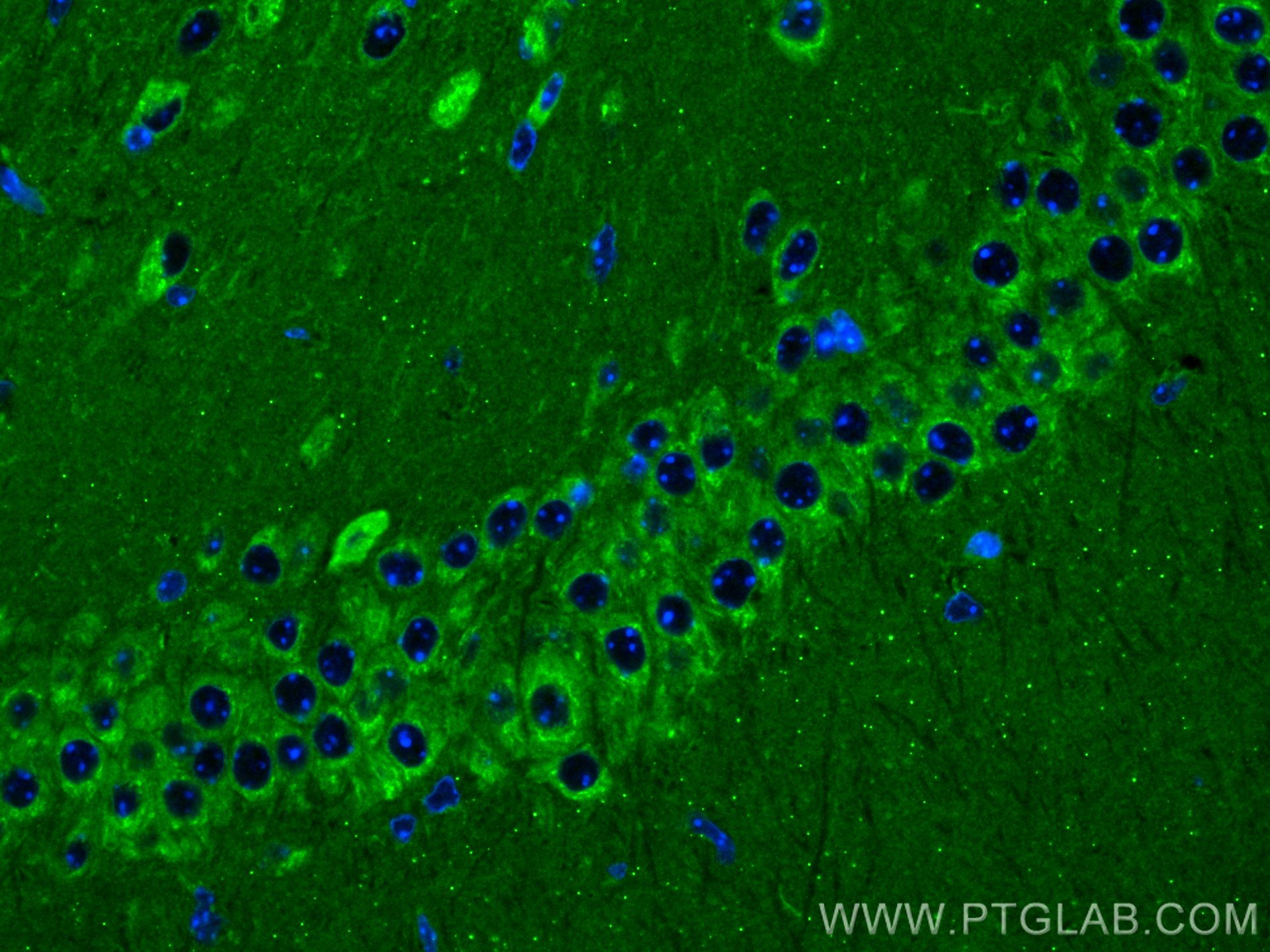 Immunofluorescence (IF) / fluorescent staining of mouse brain tissue using Rab18 Polyclonal antibody (11304-1-AP)