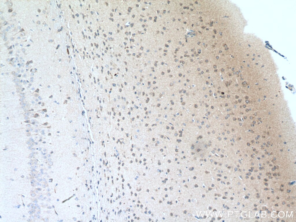 Immunohistochemistry (IHC) staining of mouse brain tissue using Rab18 Polyclonal antibody (11304-1-AP)