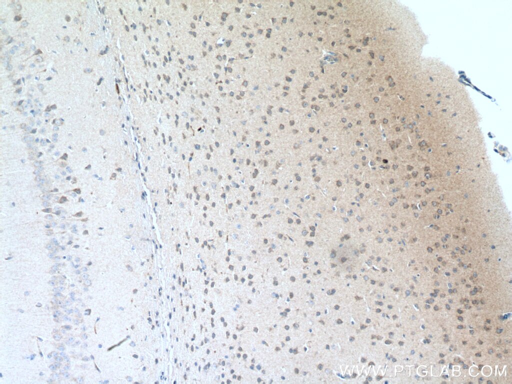 Immunohistochemistry (IHC) staining of mouse brain tissue using Rab18 Polyclonal antibody (11304-1-AP)
