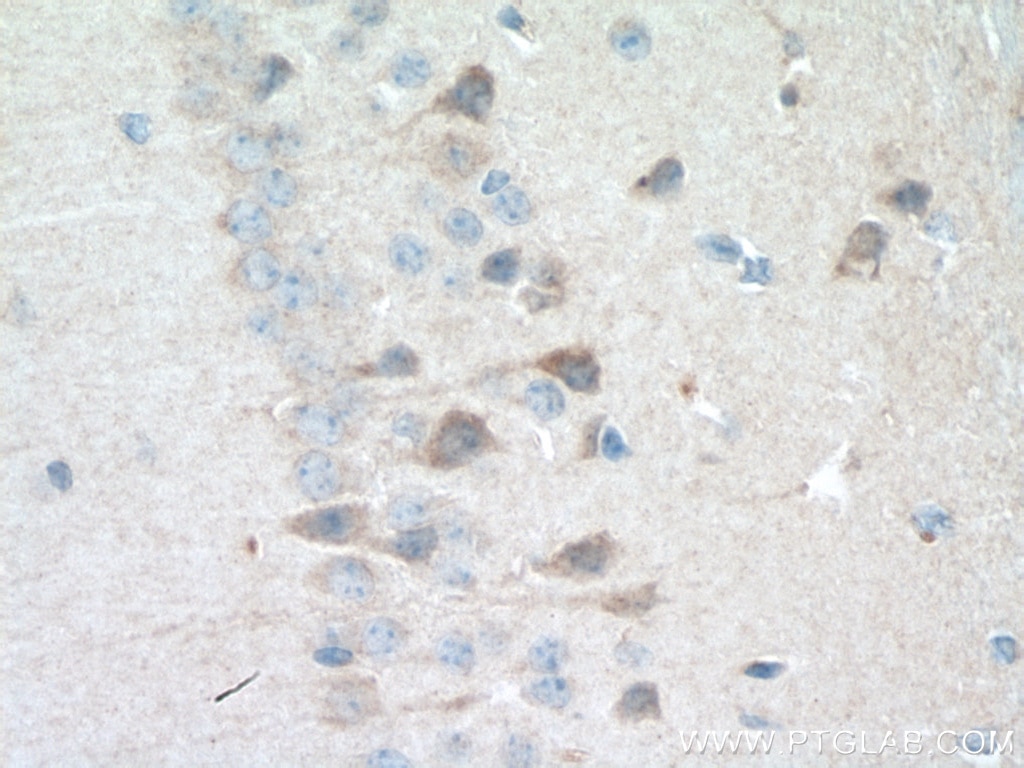 Immunohistochemistry (IHC) staining of mouse brain tissue using Rab18 Polyclonal antibody (11304-1-AP)