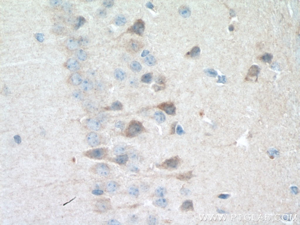 Immunohistochemistry (IHC) staining of mouse brain tissue using Rab18 Polyclonal antibody (11304-1-AP)