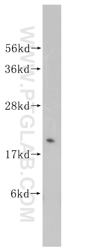 Western Blot (WB) analysis of human heart tissue using Rab18 Polyclonal antibody (11304-1-AP)