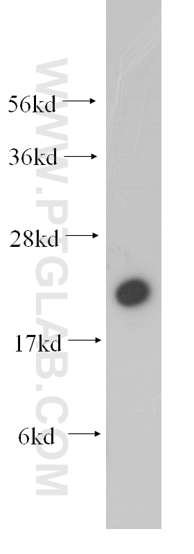 Western Blot (WB) analysis of human brain tissue using Rab18 Polyclonal antibody (11304-1-AP)