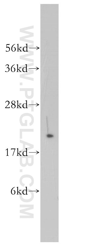 Western Blot (WB) analysis of PC-3 cells using Rab18 Polyclonal antibody (11304-1-AP)