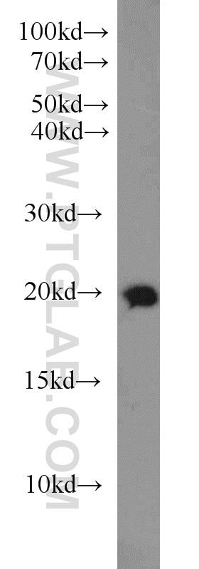 Western Blot (WB) analysis of human testis tissue using Rab18 Polyclonal antibody (11304-1-AP)