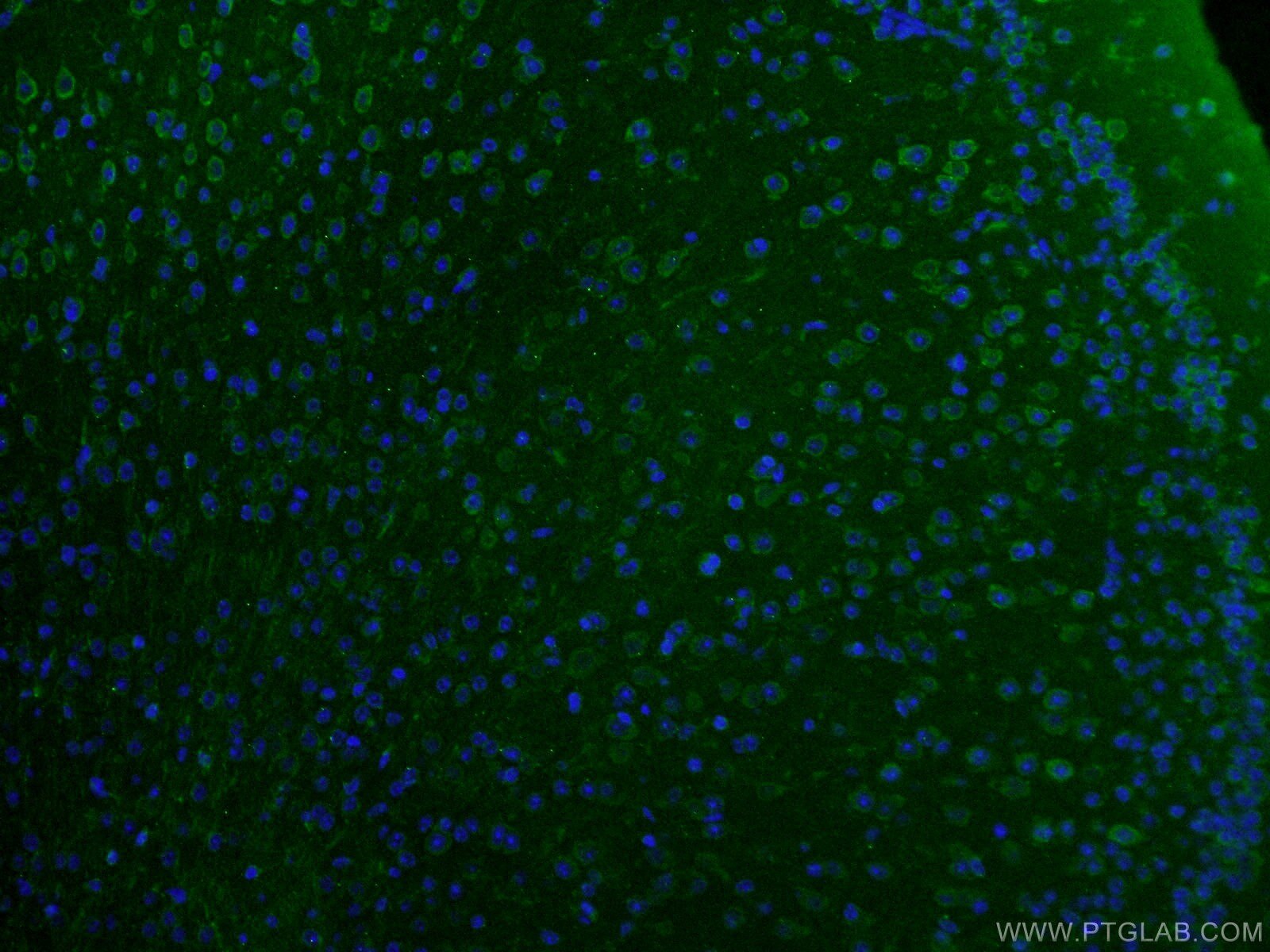 Immunofluorescence (IF) / fluorescent staining of mouse brain tissue using Rab18 Monoclonal antibody (60057-1-Ig)