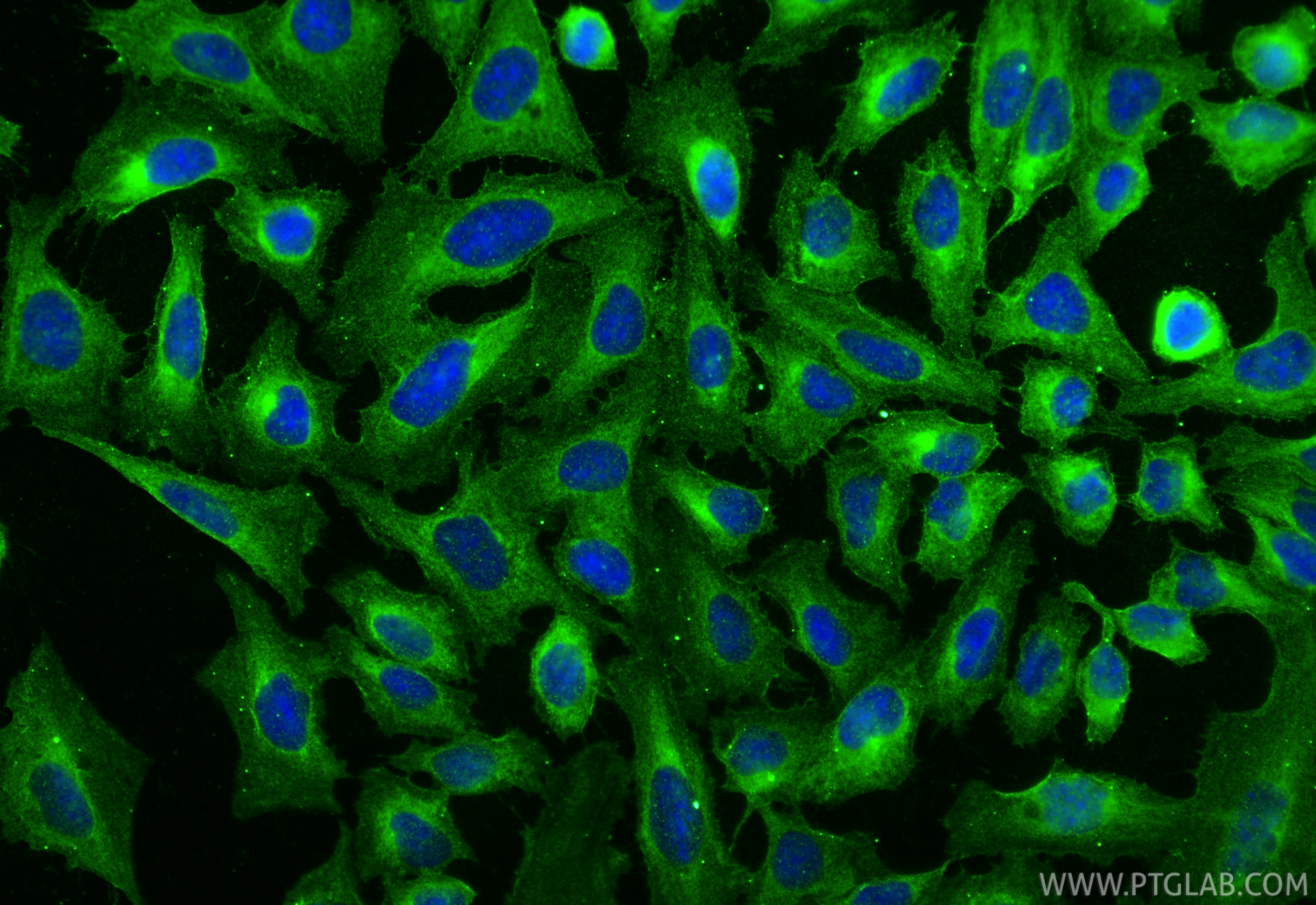 Immunofluorescence (IF) / fluorescent staining of U2OS cells using RAB18 Monoclonal antibody (67659-1-Ig)