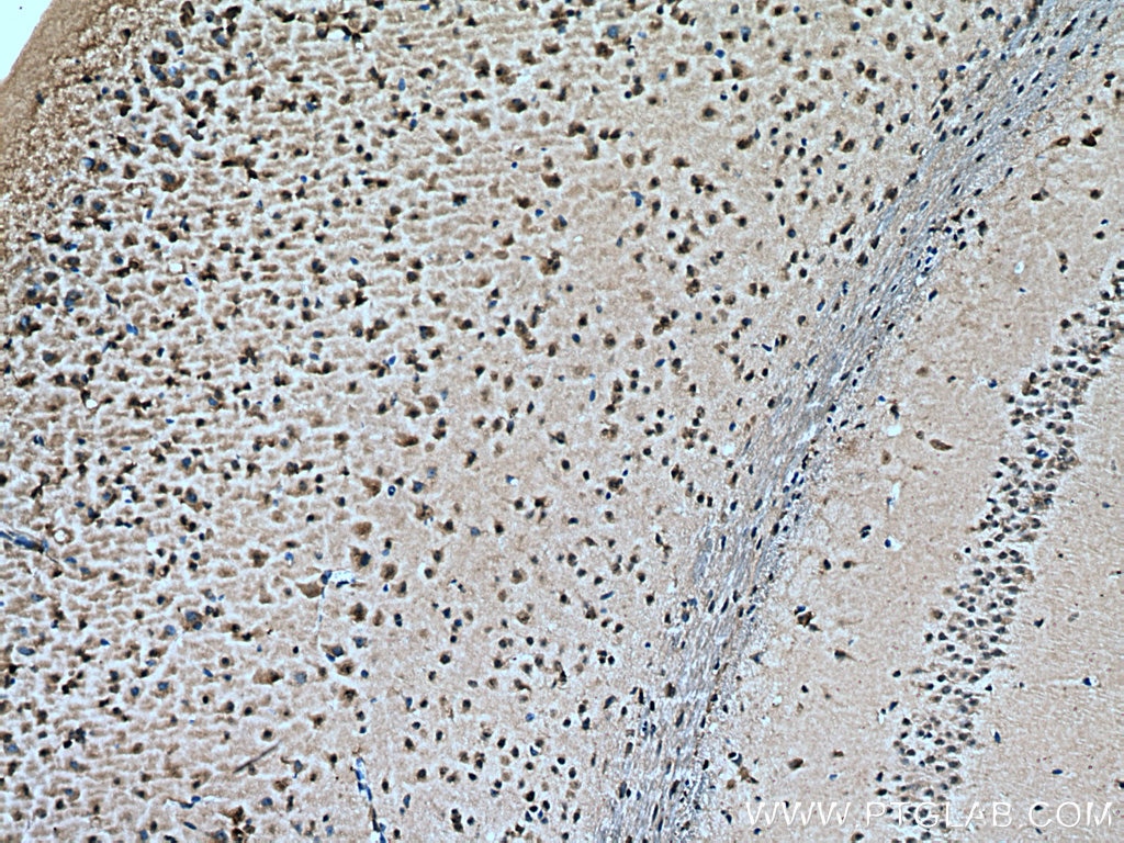 IHC staining of mouse brain using 67659-1-Ig