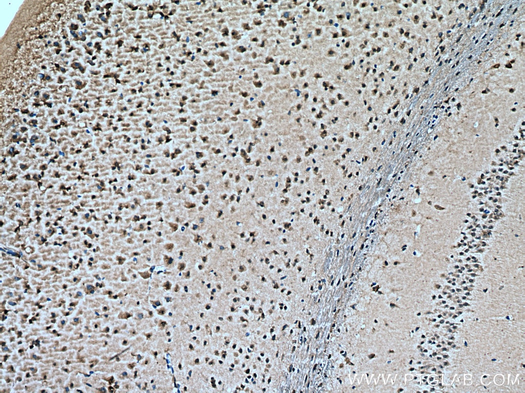 Immunohistochemistry (IHC) staining of mouse brain tissue using RAB18 Monoclonal antibody (67659-1-Ig)