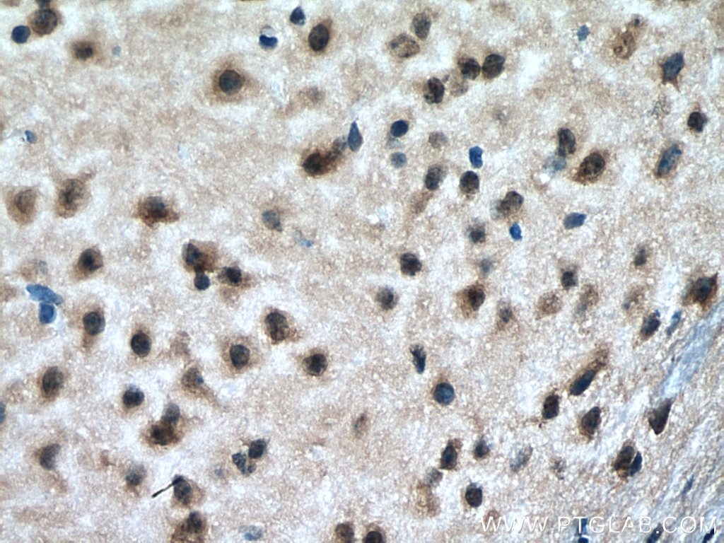 Immunohistochemistry (IHC) staining of mouse brain tissue using RAB18 Monoclonal antibody (67659-1-Ig)