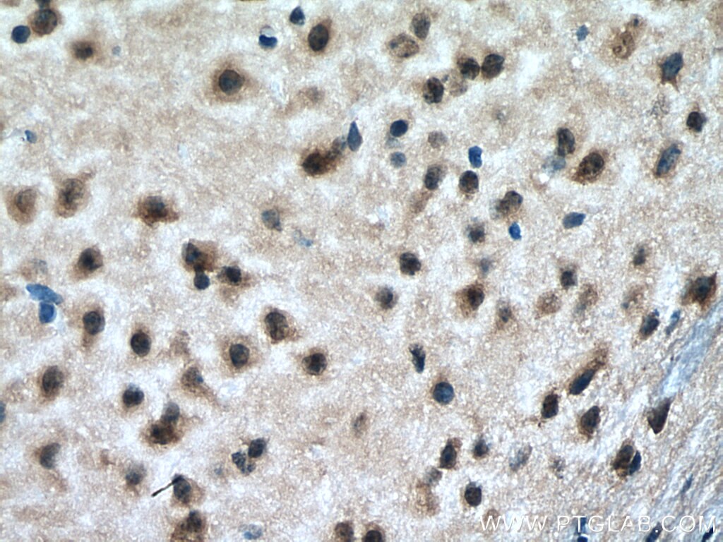 IHC staining of mouse brain using 67659-1-Ig