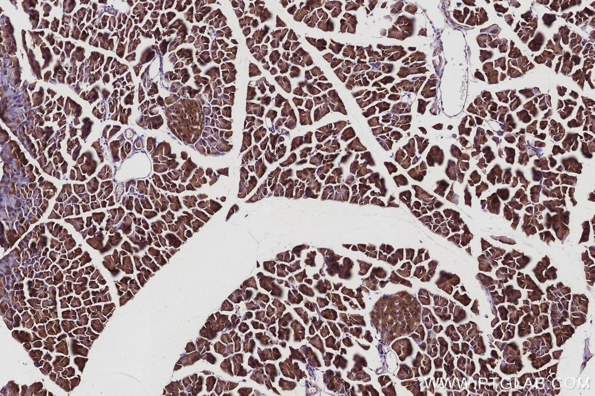 Immunohistochemistry (IHC) staining of mouse pancreas tissue using RAB18 Monoclonal antibody (67659-1-Ig)