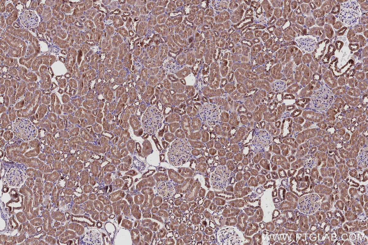 Immunohistochemistry (IHC) staining of rat kidney tissue using RAB18 Monoclonal antibody (67659-1-Ig)