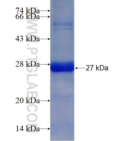 RAB18 fusion protein Ag16669 SDS-PAGE