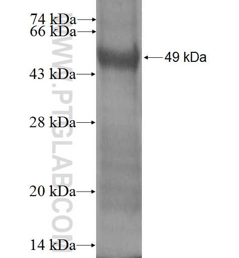 RAB18 fusion protein Ag1841 SDS-PAGE