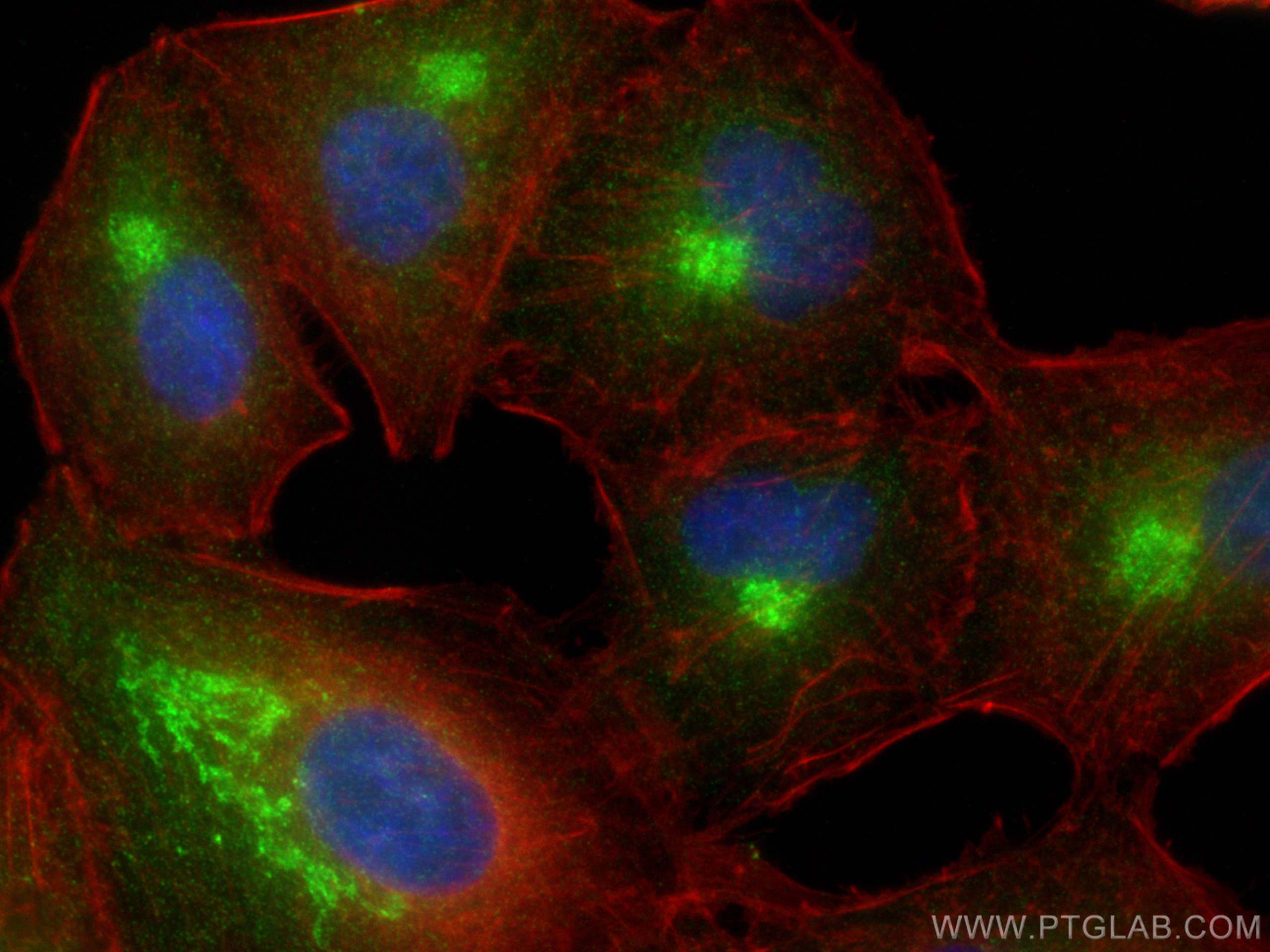Immunofluorescence (IF) / fluorescent staining of A549 cells using RAB1A Polyclonal antibody (11671-1-AP)