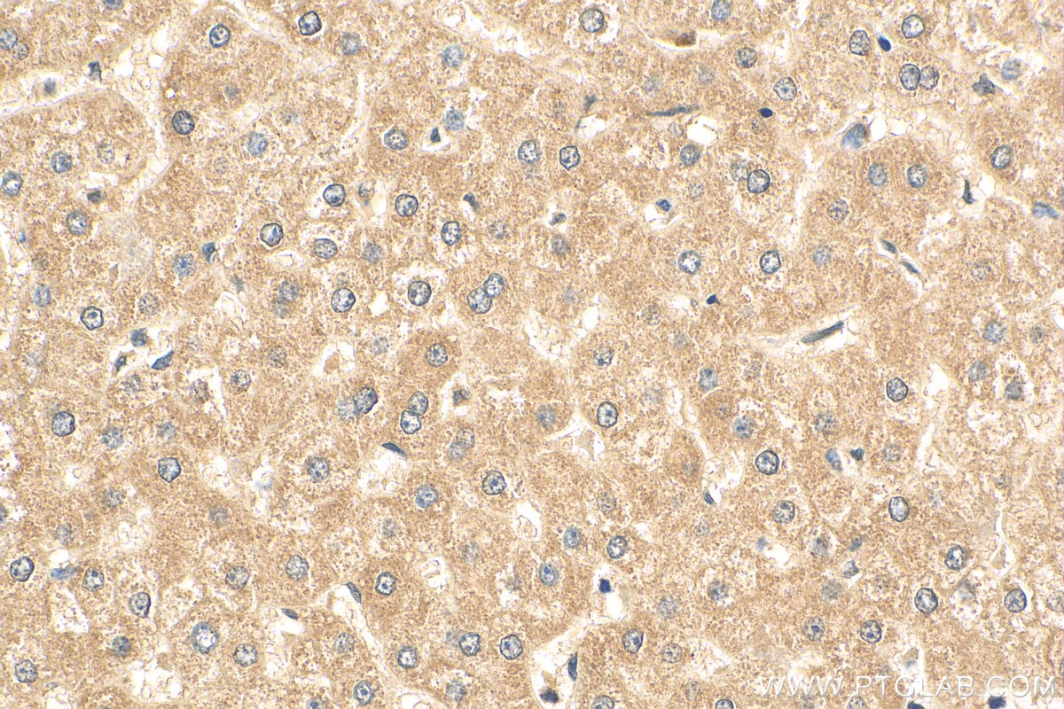 IHC staining of human liver using 11671-1-AP