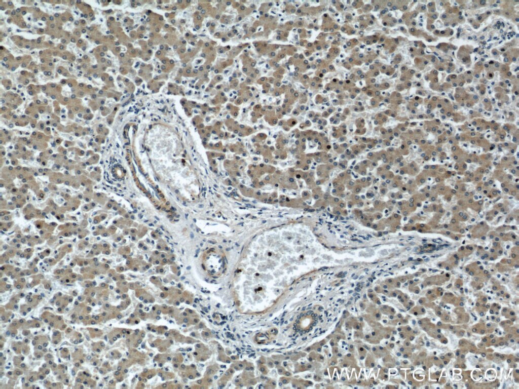 Immunohistochemistry (IHC) staining of human liver tissue using RAB1A Polyclonal antibody (11671-1-AP)