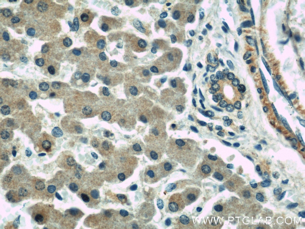 Immunohistochemistry (IHC) staining of human liver tissue using RAB1A Polyclonal antibody (11671-1-AP)