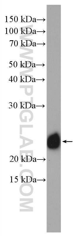 Western Blot (WB) analysis of U-251 cells using RAB1A Polyclonal antibody (11671-1-AP)