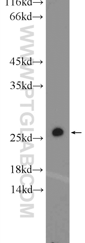 RAB1A Polyclonal antibody
