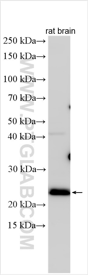 Western Blot (WB) analysis of various lysates using RAB1A Polyclonal antibody (11671-1-AP)