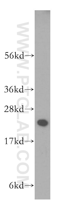 Western Blot (WB) analysis of human brain tissue using RAB1A Polyclonal antibody (11671-1-AP)