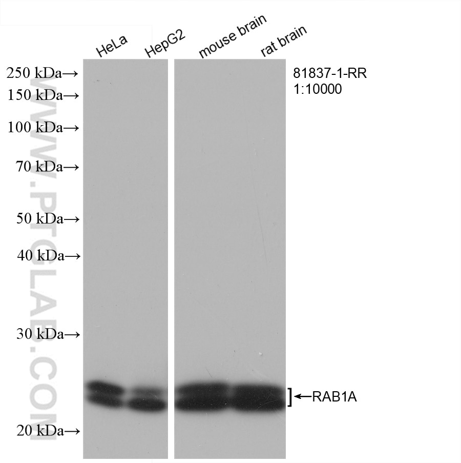 Western Blot (WB) analysis of various lysates using RAB1A Recombinant antibody (81837-1-RR)