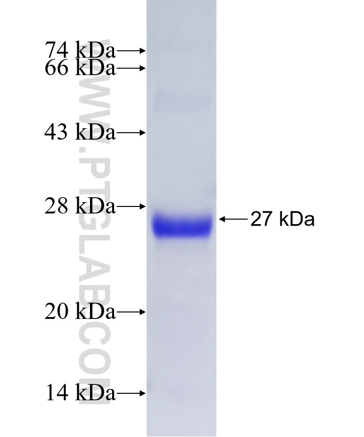 RAB1A fusion protein Ag28047 SDS-PAGE