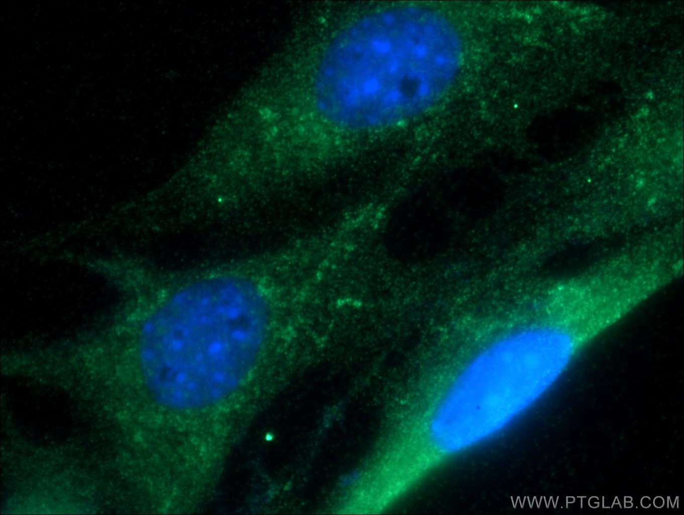 Immunofluorescence (IF) / fluorescent staining of NIH/3T3 cells using RAB1B Polyclonal antibody (17824-1-AP)