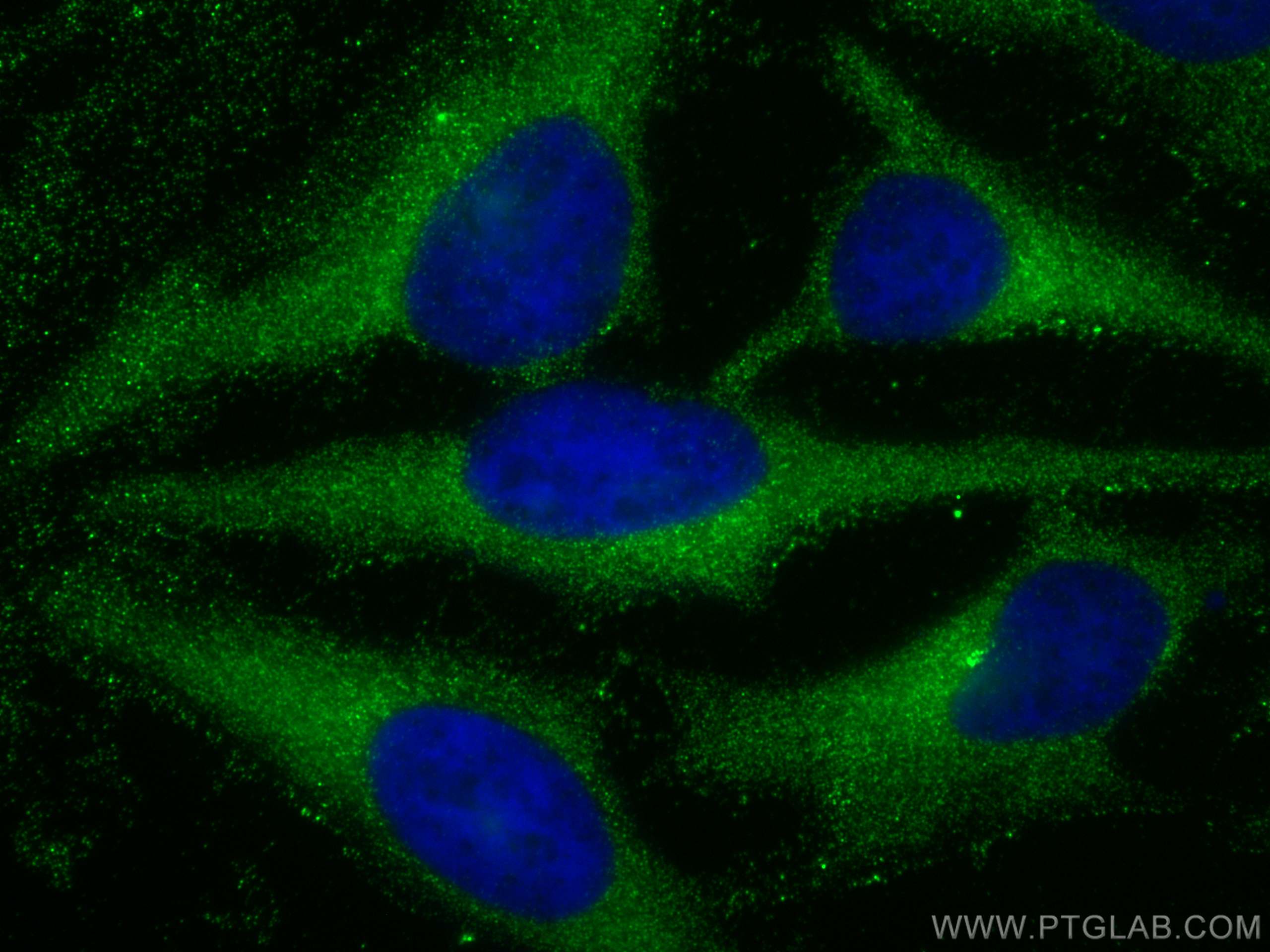 Immunofluorescence (IF) / fluorescent staining of HeLa cells using RAB1B Polyclonal antibody (17824-1-AP)
