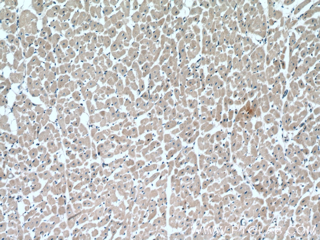 Immunohistochemistry (IHC) staining of human heart tissue using RAB1B Polyclonal antibody (17824-1-AP)