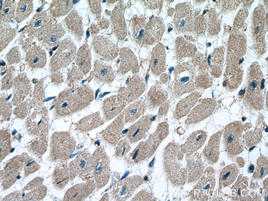 Immunohistochemistry (IHC) staining of human heart tissue using RAB1B Polyclonal antibody (17824-1-AP)