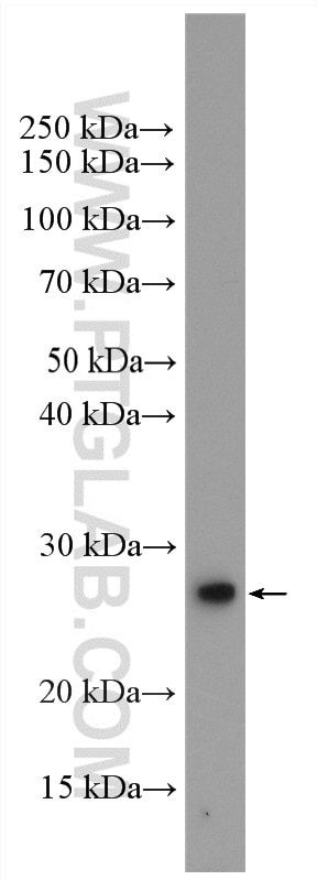 Western Blot (WB) analysis of A375 cells using RAB1B Polyclonal antibody (17824-1-PBS)