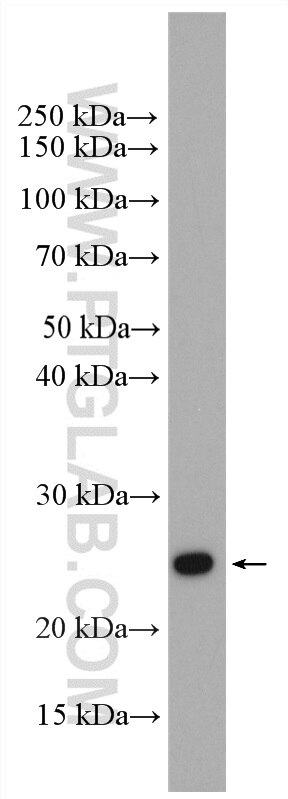 Western Blot (WB) analysis of HeLa cells using RAB1B Polyclonal antibody (17824-1-PBS)