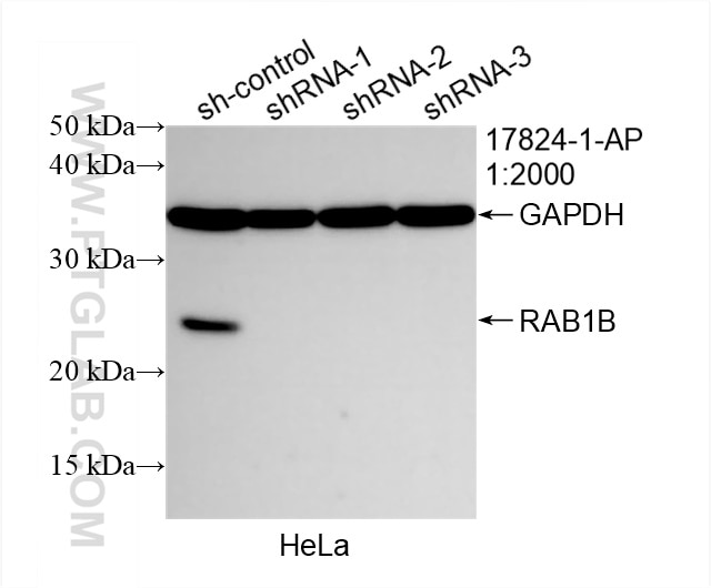 Western Blot (WB) analysis of HeLa cells using RAB1B Polyclonal antibody (17824-1-AP)