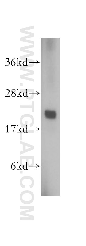 Western Blot (WB) analysis of A431 cells using RAB1B Polyclonal antibody (17824-1-AP)