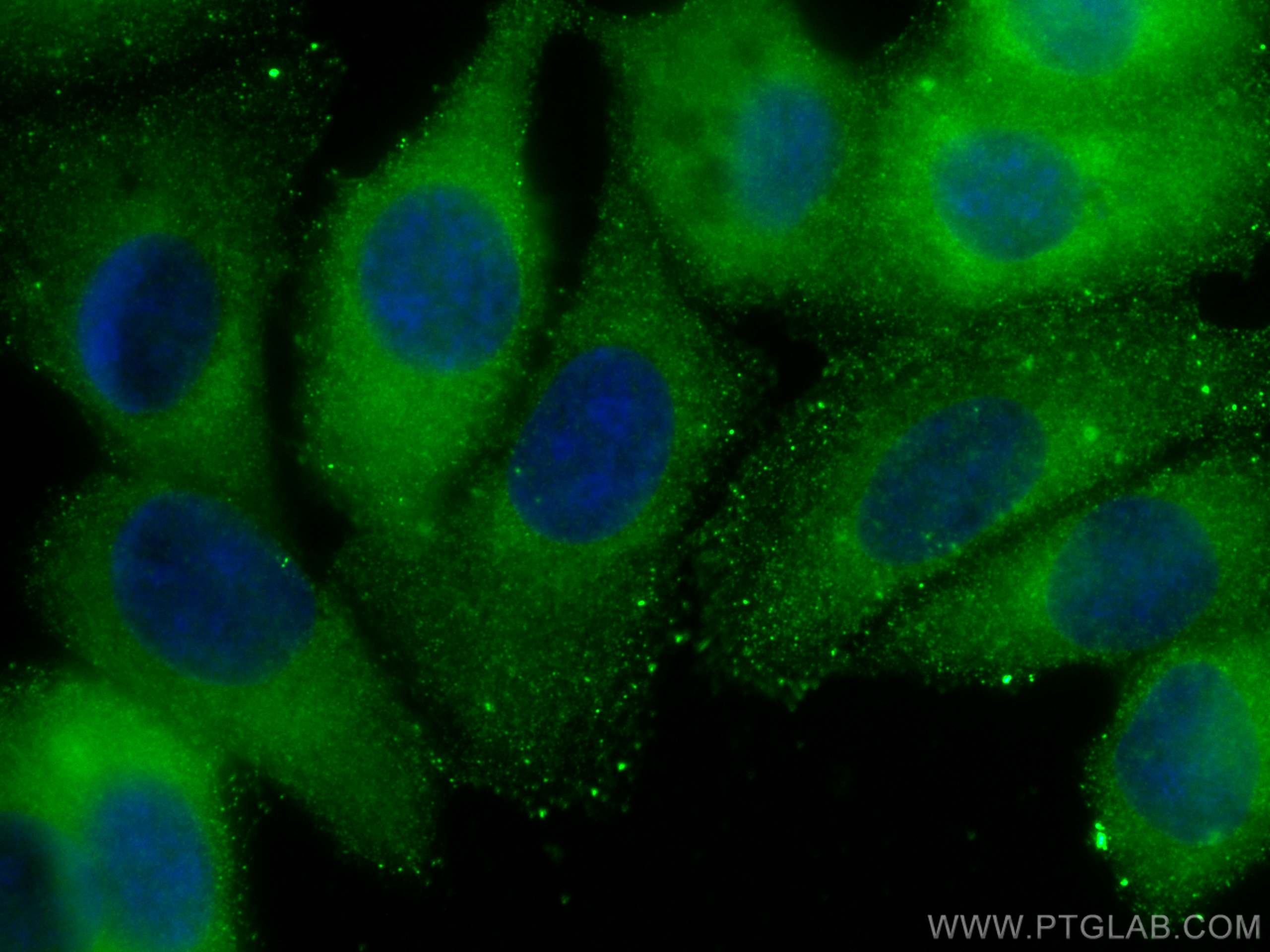 Immunofluorescence (IF) / fluorescent staining of MCF-7 cells using RAB1B Monoclonal antibody (67837-1-Ig)