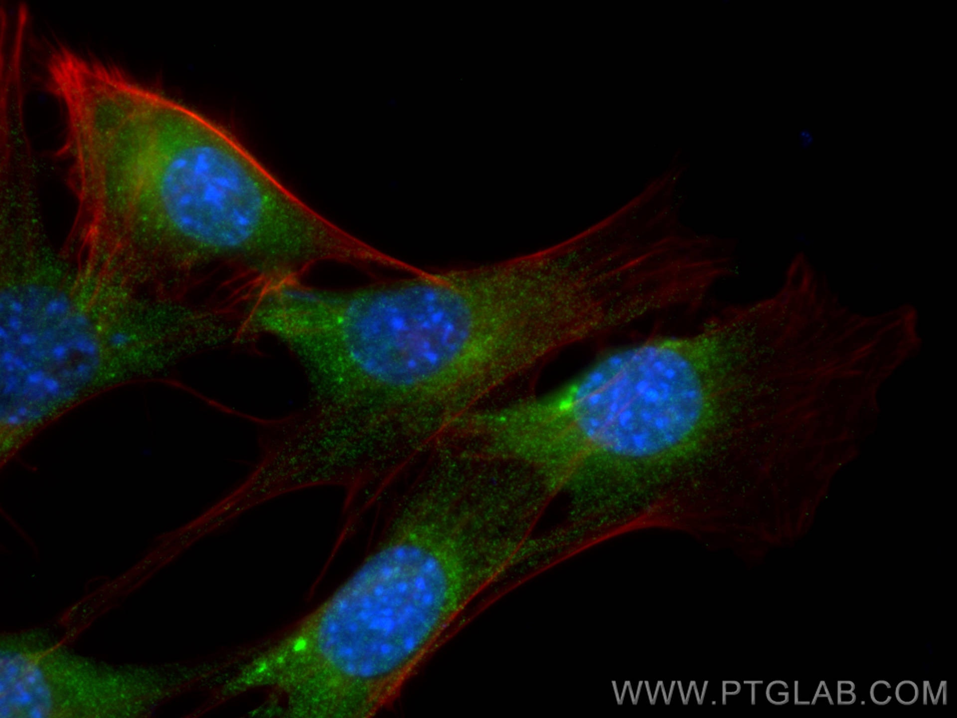 Immunofluorescence (IF) / fluorescent staining of NIH/3T3 cells using RAB1B Monoclonal antibody (67837-1-Ig)