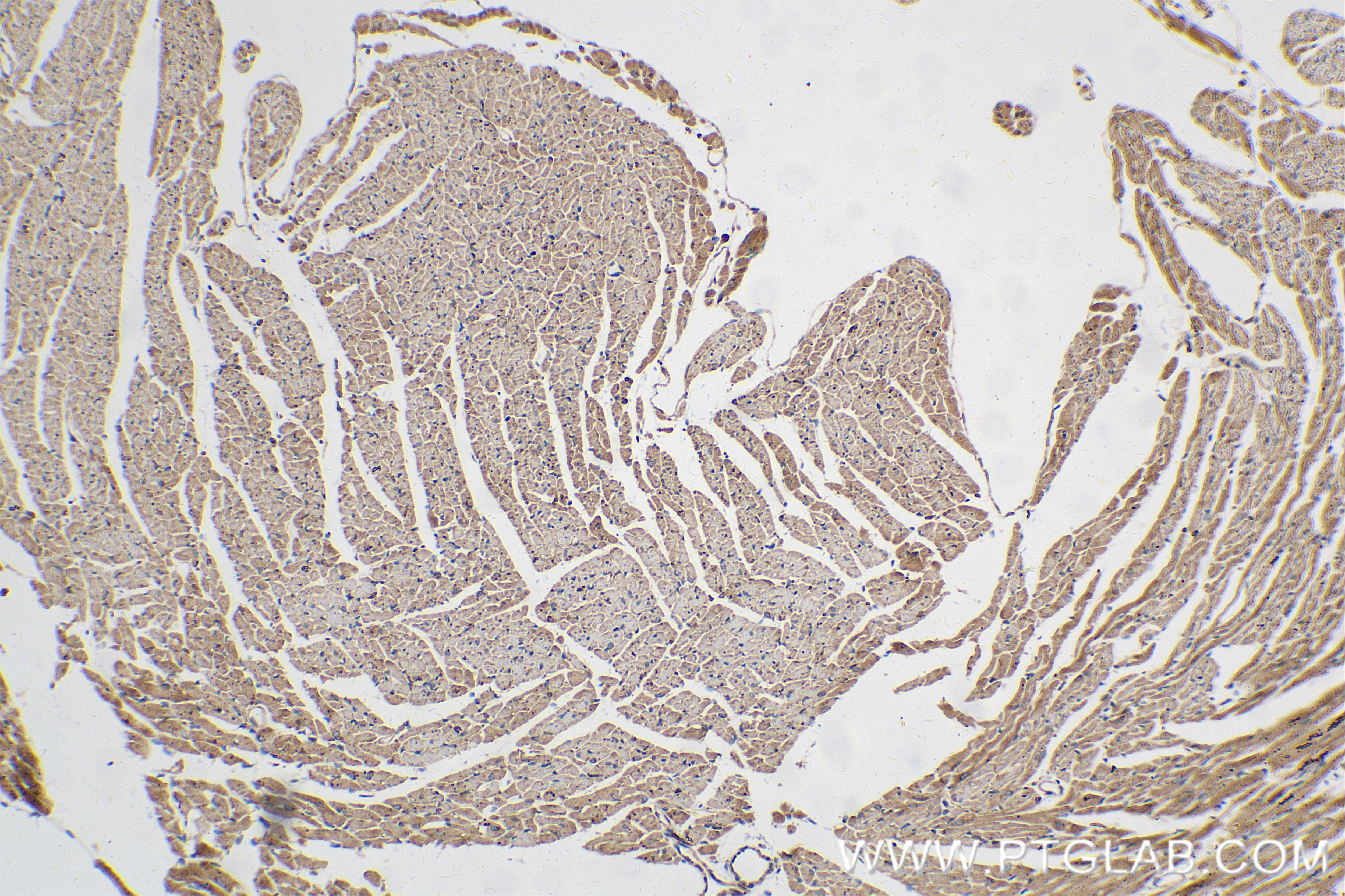 Immunohistochemistry (IHC) staining of mouse heart tissue using RAB1B Recombinant antibody (83687-4-RR)