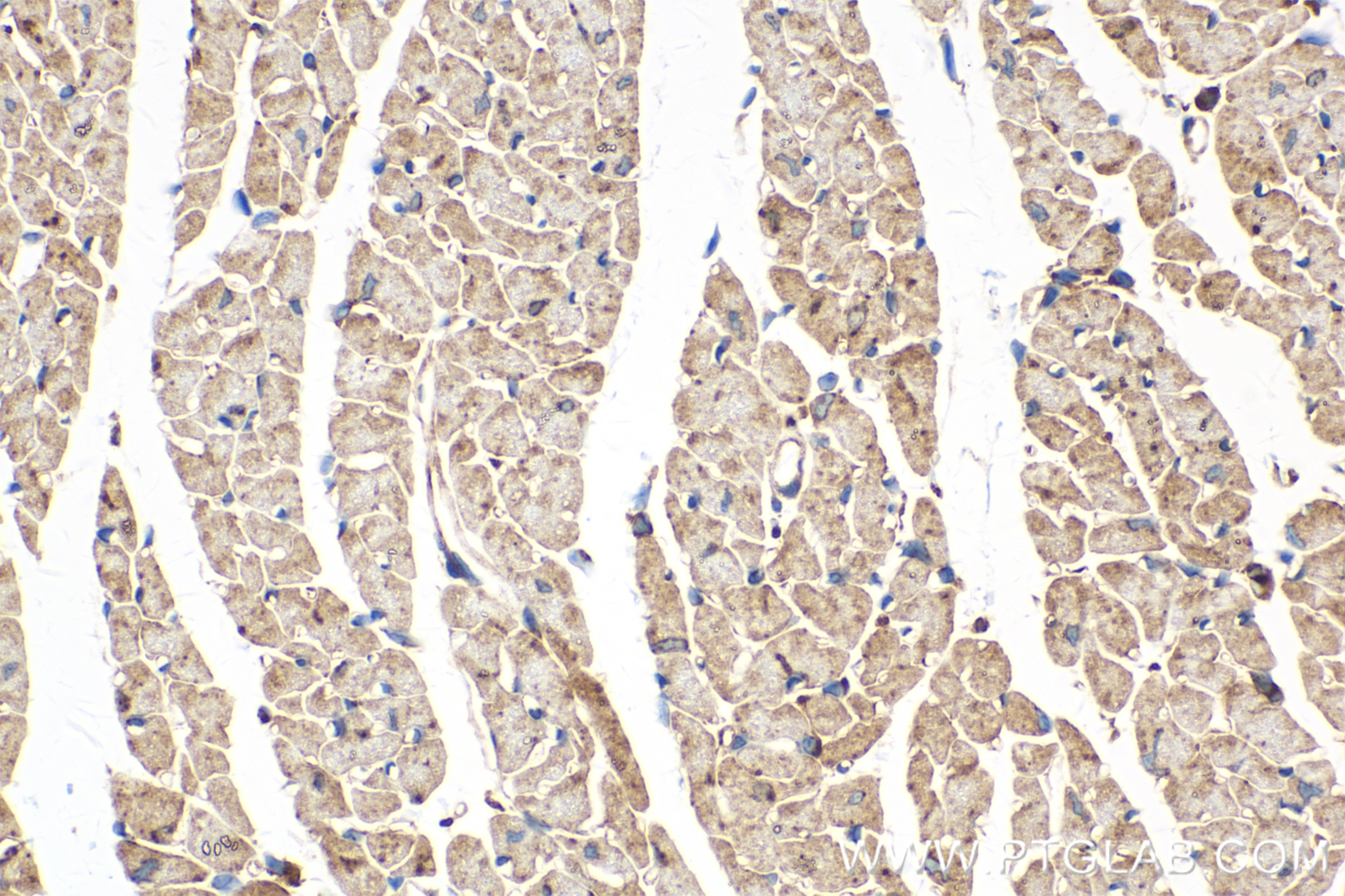 Immunohistochemistry (IHC) staining of mouse heart tissue using RAB1B Recombinant antibody (83687-4-RR)
