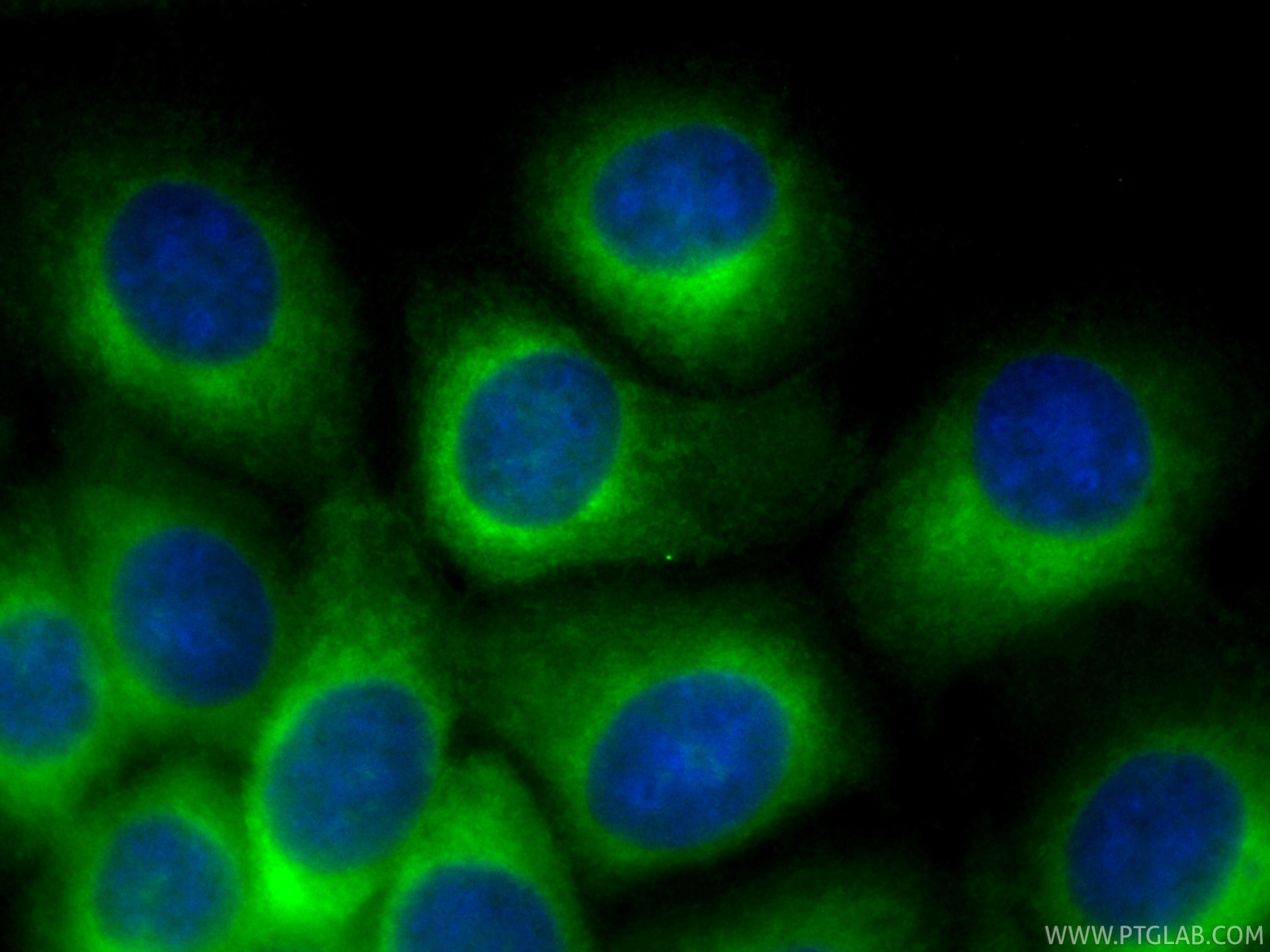 Immunofluorescent analysis of (-20°C Methanol) fixed MCF-7 cells using CoraLite® Plus 488 RAB1B antibody (CL488-83687-4, Clone: 240635D9 ) at dilution of 1:200. Immunofluorescence (IF) / fluorescent staining of MCF-7 cells using CoraLite® Plus 488-conjugated RAB1B Recombinant mo (CL488-83687-4)