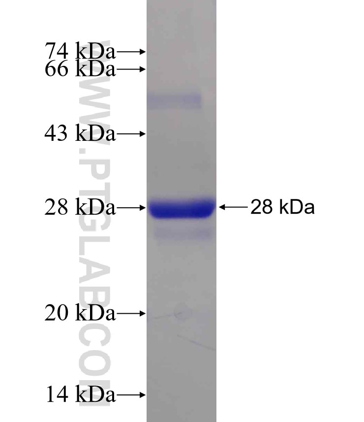 RAB1B fusion protein Ag12069 SDS-PAGE
