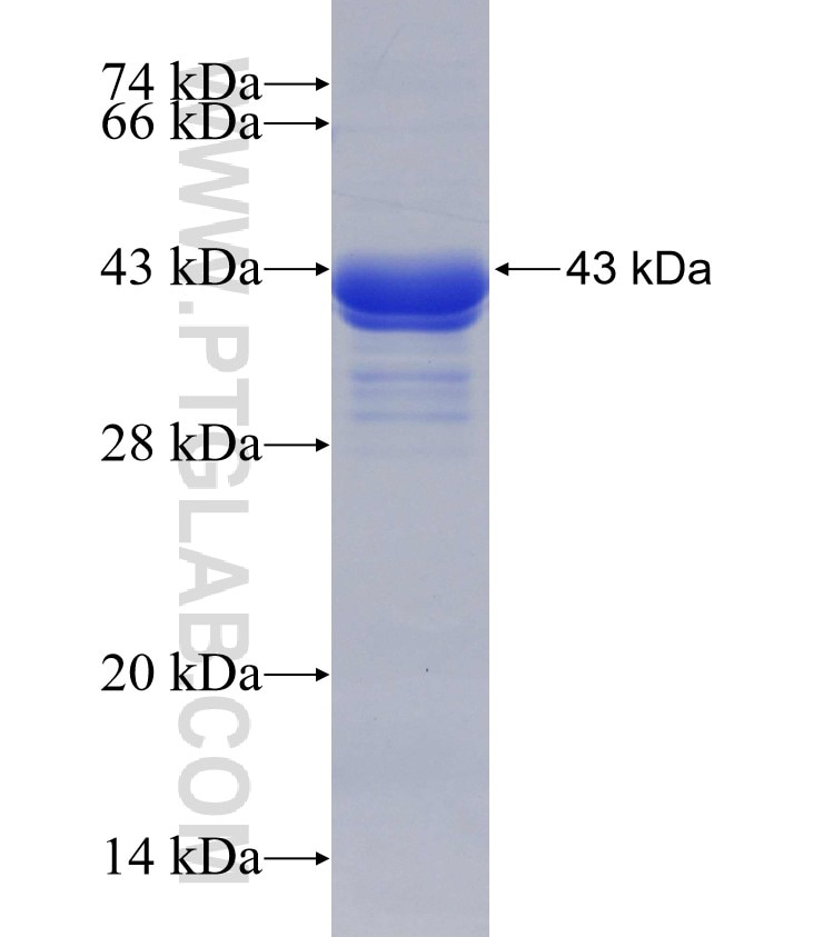 RAB20 fusion protein Ag30459 SDS-PAGE
