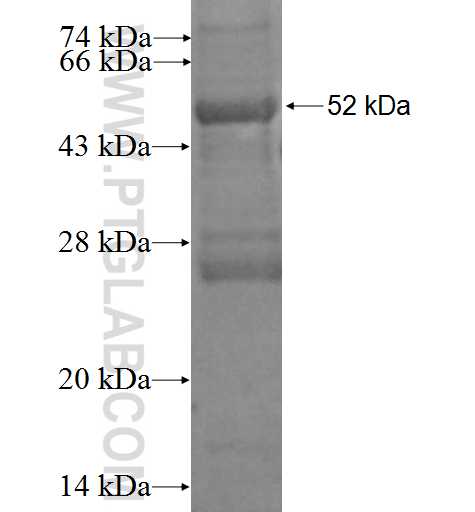 RAB20 fusion protein Ag2193 SDS-PAGE