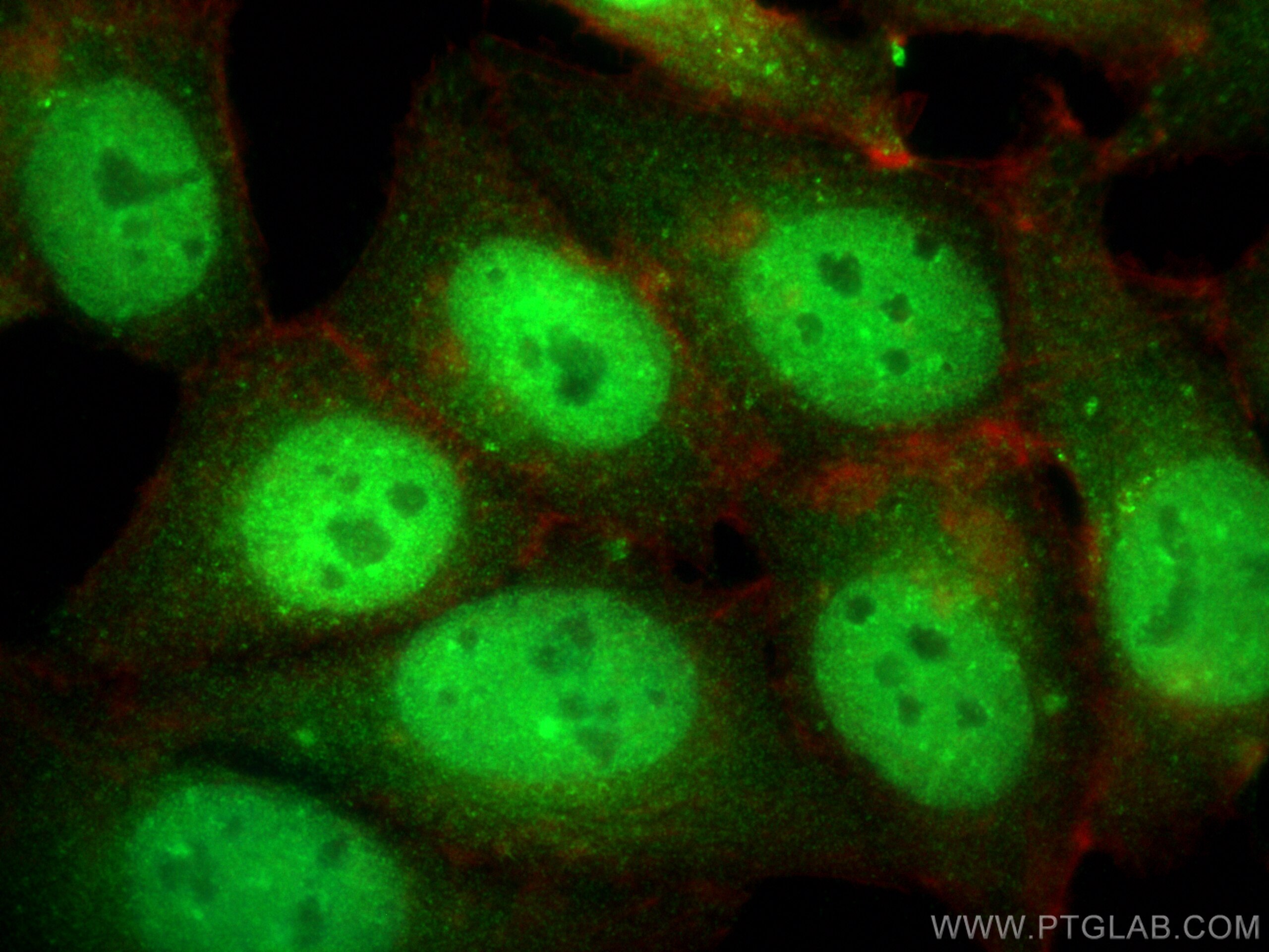 Immunofluorescence (IF) / fluorescent staining of MCF-7 cells using RAB21 Polyclonal antibody (31303-1-AP)