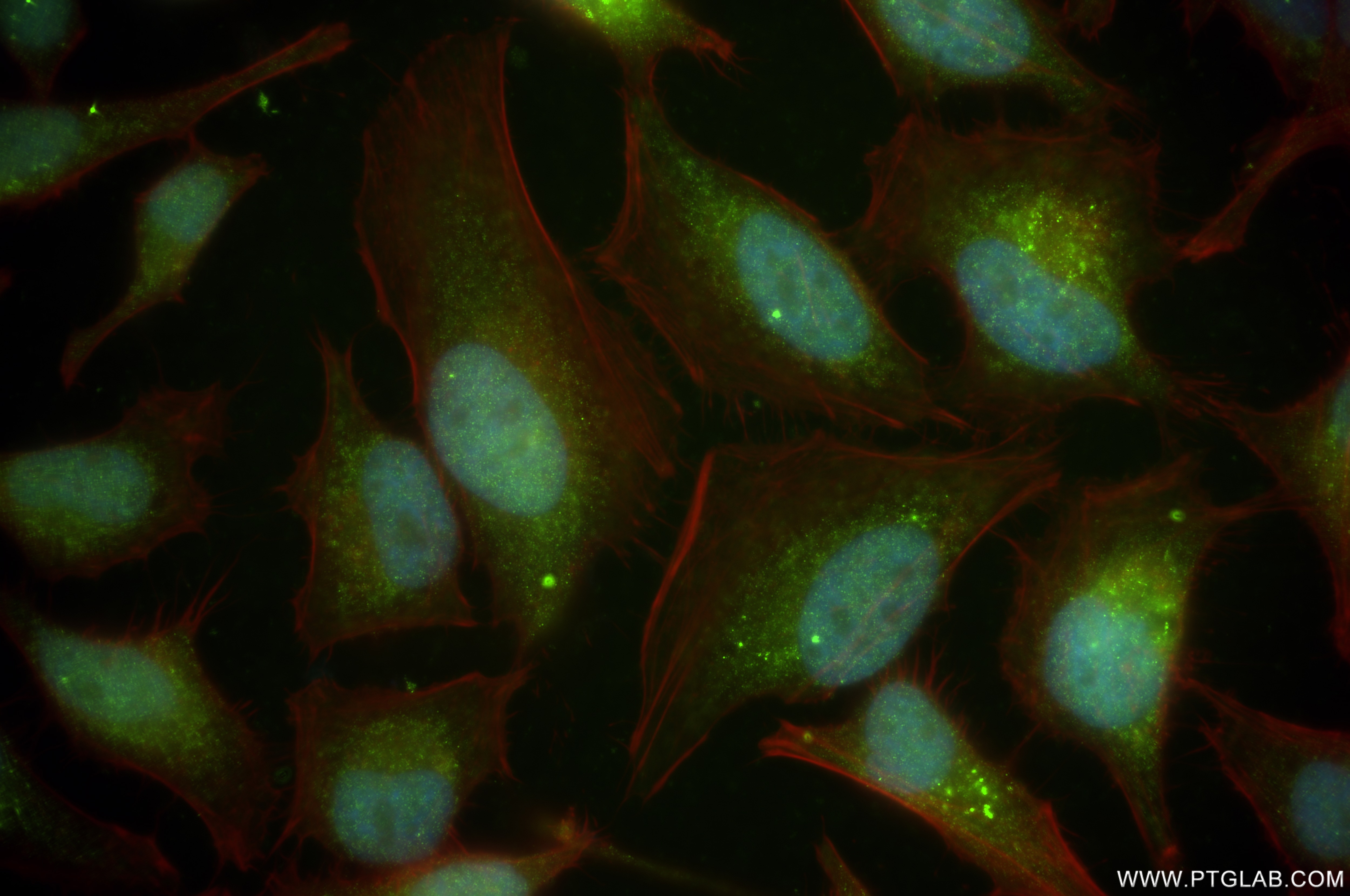Immunofluorescence (IF) / fluorescent staining of HeLa cells using RAB21 Recombinant antibody (84776-2-RR)