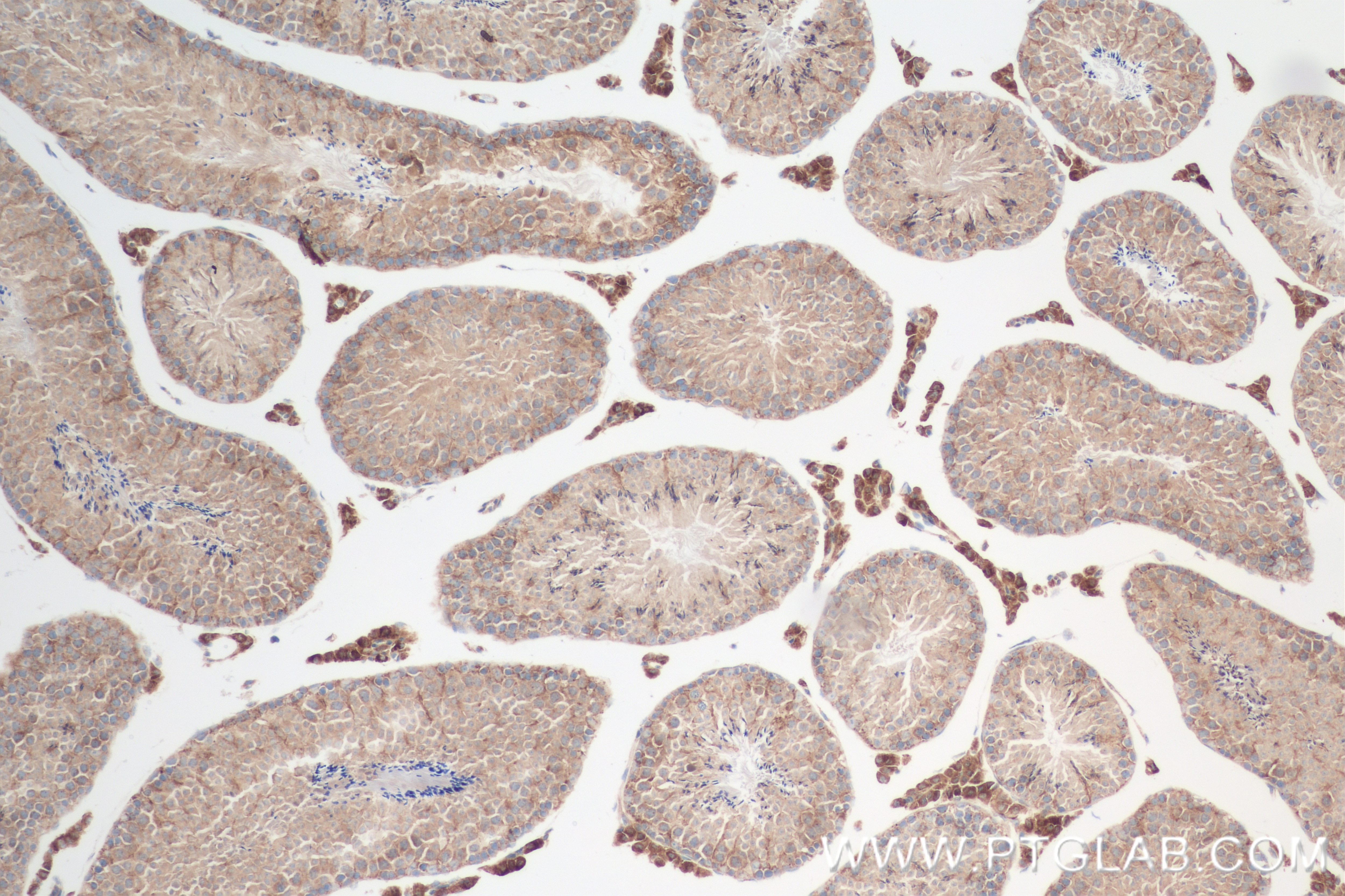 Immunohistochemistry (IHC) staining of mouse testis tissue using RAB21 Recombinant antibody (84776-2-RR)
